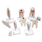 Modely zubov "Klasik" - 1017588B3
